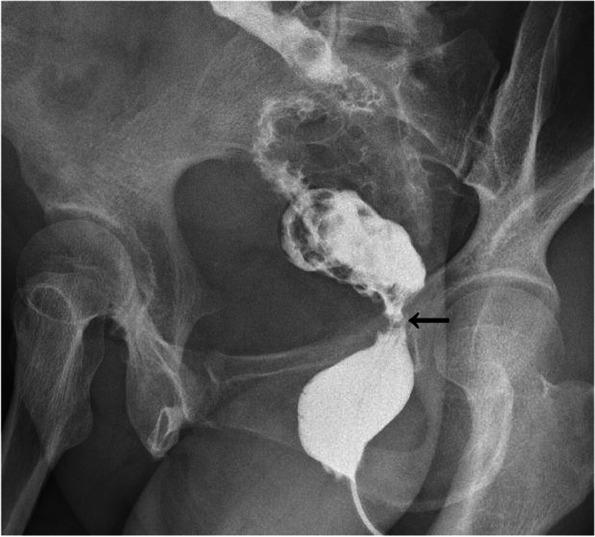 https://cdn.ncbi.nlm.nih.gov/pmc/blobs/c3c3/9074226/ac01bd058b4b/12957_2022_2610_Fig3_HTML.jpg