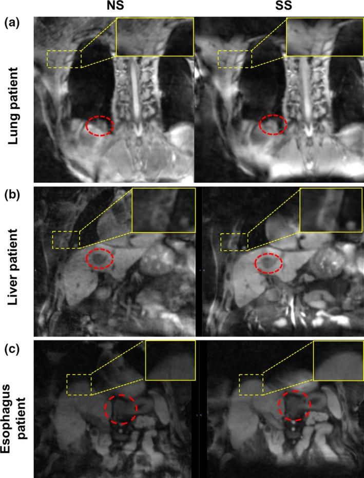 https://cdn.ncbi.nlm.nih.gov/pmc/blobs/c3c4/5689937/eca1aae805d8/ACM2-18-250-g005.jpg