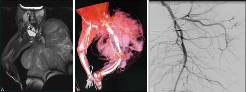 https://cdn.ncbi.nlm.nih.gov/pmc/blobs/c3c4/7440069/e65198d3a228/medi-99-e19489-g002.jpg