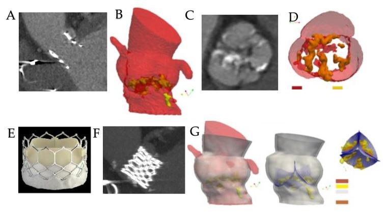 https://cdn.ncbi.nlm.nih.gov/pmc/blobs/c3c5/9312295/20b665518b44/bioengineering-09-00299-g005.jpg