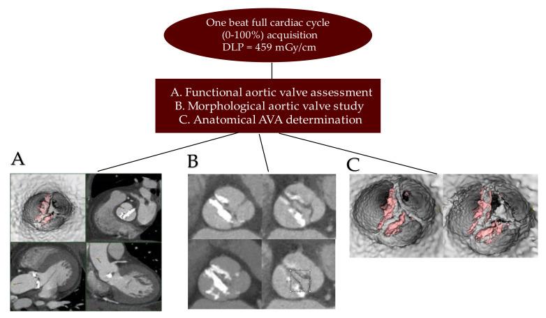 https://cdn.ncbi.nlm.nih.gov/pmc/blobs/c3c5/9312295/c2d21df8d4dd/bioengineering-09-00299-g004.jpg