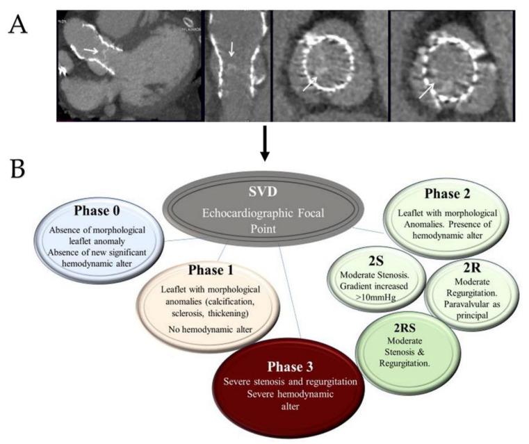 https://cdn.ncbi.nlm.nih.gov/pmc/blobs/c3c5/9312295/c2d29f1da6d6/bioengineering-09-00299-g009.jpg