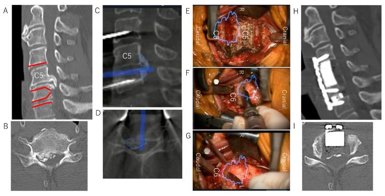 https://cdn.ncbi.nlm.nih.gov/pmc/blobs/c3c8/10143834/b247574f760a/jcm-12-02898-g004.jpg