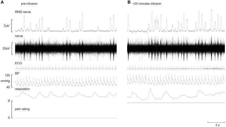 https://cdn.ncbi.nlm.nih.gov/pmc/blobs/c3c9/4681770/ed1426b95024/fnins-09-00471-g0001.jpg