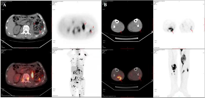 https://cdn.ncbi.nlm.nih.gov/pmc/blobs/c3ce/9950125/2f0f5d61c5e7/pore-29-1610856-g003.jpg