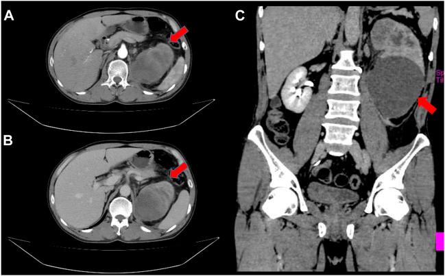 https://cdn.ncbi.nlm.nih.gov/pmc/blobs/c3ce/9950125/edb75e174695/pore-29-1610856-g001.jpg