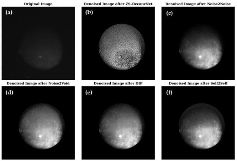 https://cdn.ncbi.nlm.nih.gov/pmc/blobs/c3d2/11679134/1baf4a15b66b/sensors-24-08143-g005.jpg