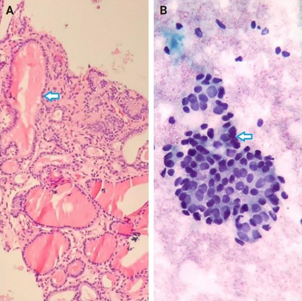 https://cdn.ncbi.nlm.nih.gov/pmc/blobs/c3d4/12138241/aa64e77215fc/jptm-2025-03-04f2.jpg