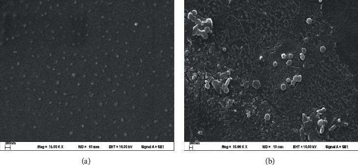https://cdn.ncbi.nlm.nih.gov/pmc/blobs/c3d4/8177972/4f7961a18328/IJBM2021-6662867.007.jpg