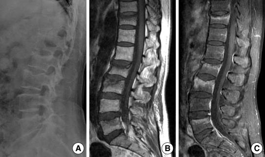 https://cdn.ncbi.nlm.nih.gov/pmc/blobs/c3dc/2826736/0a6815844ea2/jkms-25-472-g001.jpg