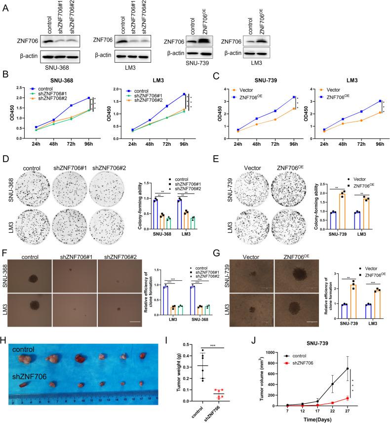https://cdn.ncbi.nlm.nih.gov/pmc/blobs/c3e1/11445280/a2e77b89cdb5/41418_2024_1324_Fig2_HTML.jpg