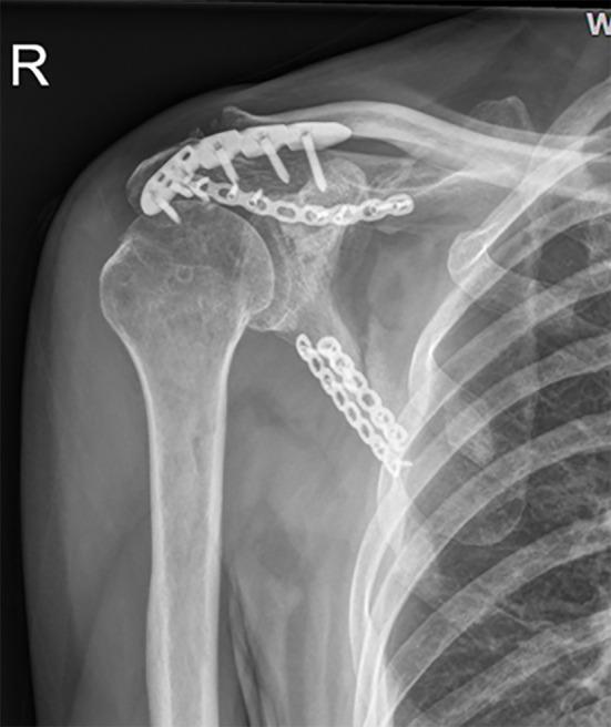 https://cdn.ncbi.nlm.nih.gov/pmc/blobs/c3ee/7760457/5e1bff0cea41/WJCC-8-6450-g005.jpg
