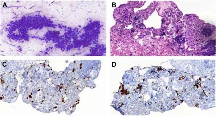 https://cdn.ncbi.nlm.nih.gov/pmc/blobs/c3f5/4976921/9740f1f453d9/ott-9-4815Fig4.jpg