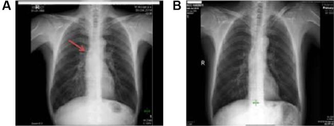 https://cdn.ncbi.nlm.nih.gov/pmc/blobs/c3f5/4976921/a6e77a31d6c3/ott-9-4815Fig2.jpg