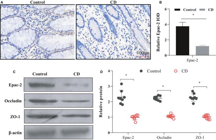 https://cdn.ncbi.nlm.nih.gov/pmc/blobs/c3fb/8742196/3e7640fbb1c3/JCMM-26-216-g004.jpg