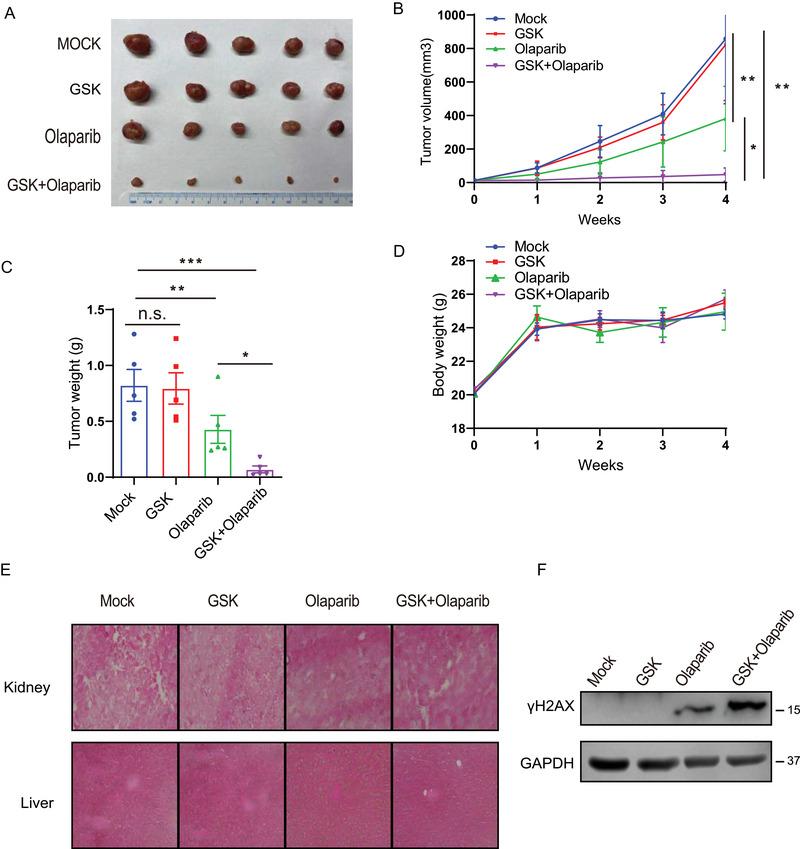 https://cdn.ncbi.nlm.nih.gov/pmc/blobs/c3ff/7908045/a647bb05c20b/CTM2-11-e341-g004.jpg