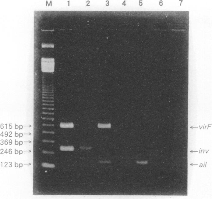 https://cdn.ncbi.nlm.nih.gov/pmc/blobs/c402/265530/30080c6271fe/jcm00033-0283-b.jpg