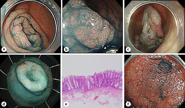 https://cdn.ncbi.nlm.nih.gov/pmc/blobs/c409/10836738/9cb9045a3022/ddi-2024-0042-0001-534968_F02.jpg