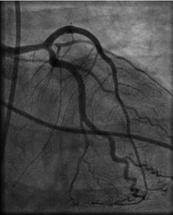 https://cdn.ncbi.nlm.nih.gov/pmc/blobs/c409/9054480/ca37c04f9b33/CRIC2022-5640965.002.jpg