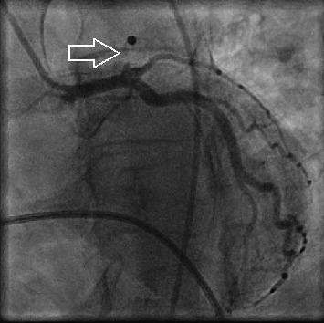 https://cdn.ncbi.nlm.nih.gov/pmc/blobs/c409/9054480/db4c40046513/CRIC2022-5640965.001.jpg
