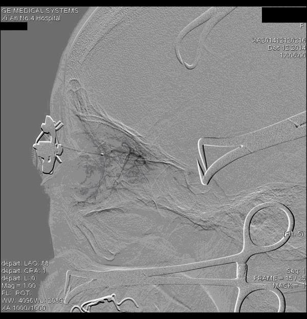 https://cdn.ncbi.nlm.nih.gov/pmc/blobs/c40f/5240882/5d2871e58bdb/medscimonit-23-114-g003.jpg