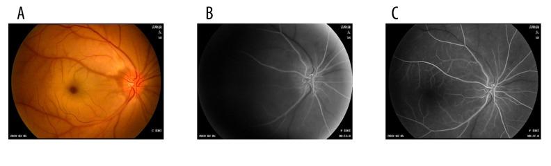 https://cdn.ncbi.nlm.nih.gov/pmc/blobs/c40f/5240882/63915e80765e/medscimonit-23-114-g008.jpg