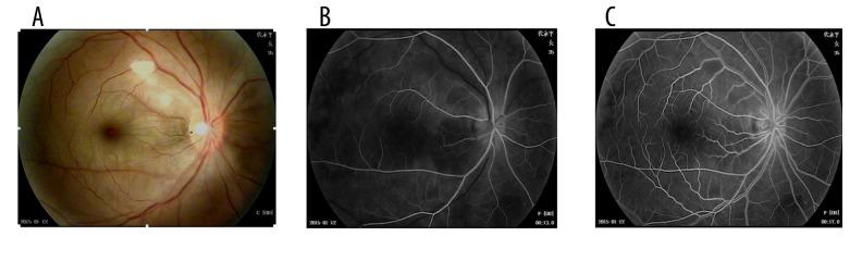 https://cdn.ncbi.nlm.nih.gov/pmc/blobs/c40f/5240882/6eac5ea38a0f/medscimonit-23-114-g006.jpg