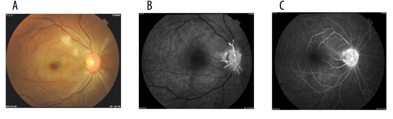 https://cdn.ncbi.nlm.nih.gov/pmc/blobs/c40f/5240882/c5af3fd8aa47/medscimonit-23-114-g005.jpg