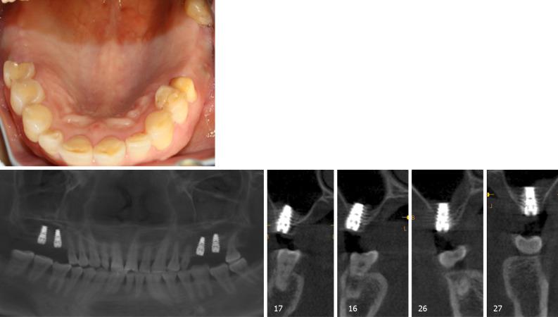 https://cdn.ncbi.nlm.nih.gov/pmc/blobs/c415/7760422/a3bac9c32a2d/WJCC-8-6408-g004.jpg