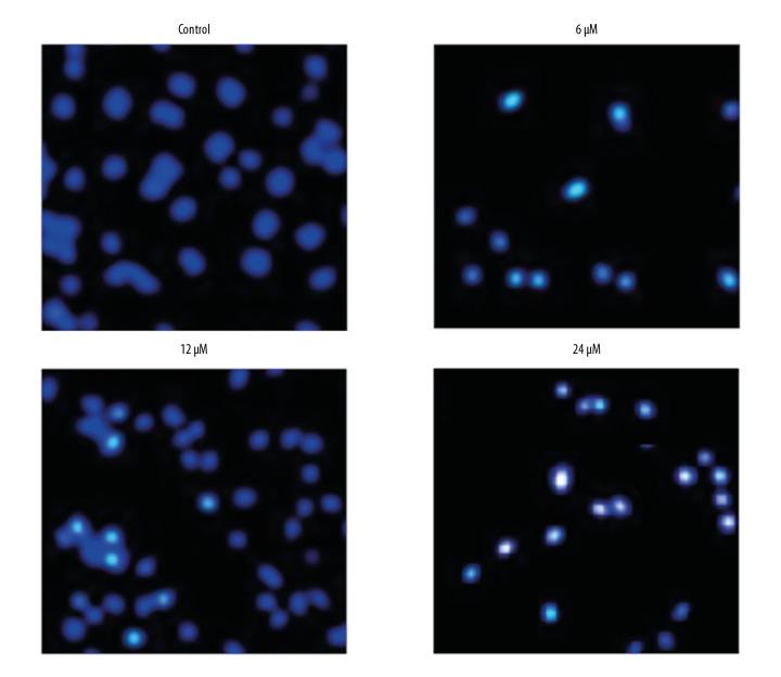 https://cdn.ncbi.nlm.nih.gov/pmc/blobs/c416/6492615/83f0b68b0f61/medscimonit-25-2935-g003.jpg