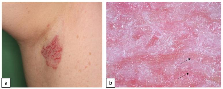 https://cdn.ncbi.nlm.nih.gov/pmc/blobs/c42b/10604867/35f4ed5e3b46/biomedicines-11-02717-g008.jpg