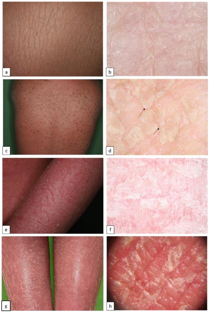 https://cdn.ncbi.nlm.nih.gov/pmc/blobs/c42b/10604867/afaa47bab410/biomedicines-11-02717-g002.jpg