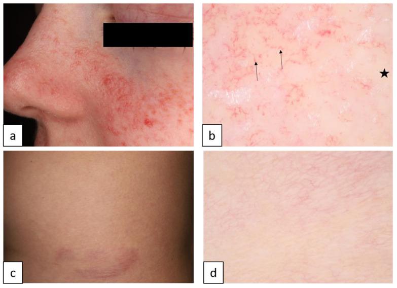 https://cdn.ncbi.nlm.nih.gov/pmc/blobs/c42b/10604867/b12332a3d841/biomedicines-11-02717-g014.jpg