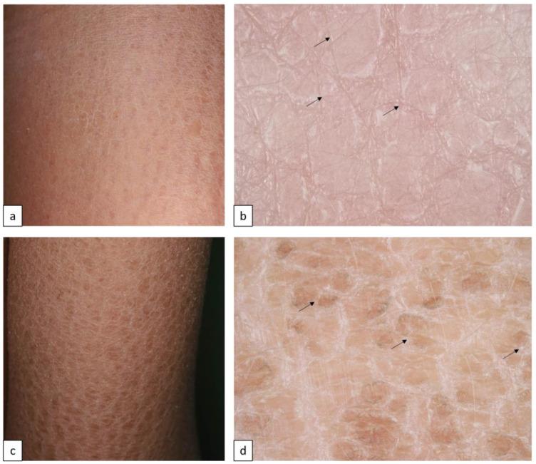 https://cdn.ncbi.nlm.nih.gov/pmc/blobs/c42b/10604867/b63d2faf6bb9/biomedicines-11-02717-g001.jpg
