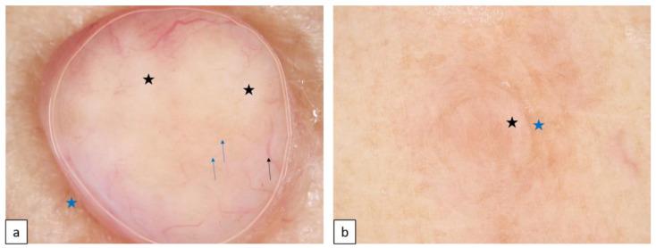 https://cdn.ncbi.nlm.nih.gov/pmc/blobs/c42b/10604867/e799c7b79aa2/biomedicines-11-02717-g012.jpg