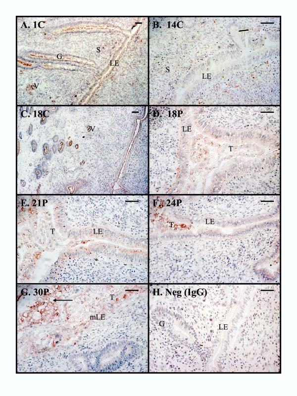 https://cdn.ncbi.nlm.nih.gov/pmc/blobs/c433/416490/412d0e46d4fb/1477-7827-2-19-4.jpg
