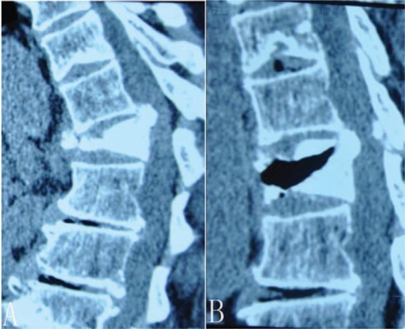 https://cdn.ncbi.nlm.nih.gov/pmc/blobs/c435/5709019/65ac81e3eb27/medi-96-e8895-g003.jpg