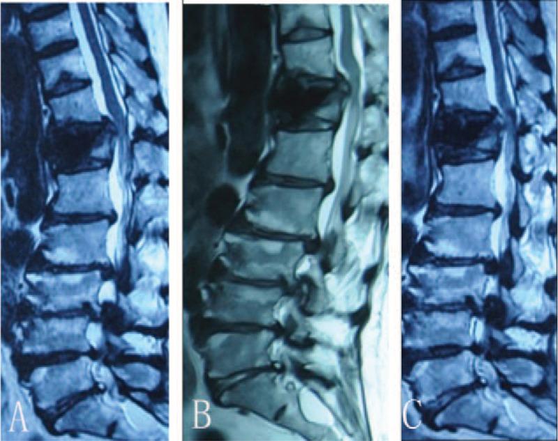 https://cdn.ncbi.nlm.nih.gov/pmc/blobs/c435/5709019/e2e7abc995e4/medi-96-e8895-g006.jpg