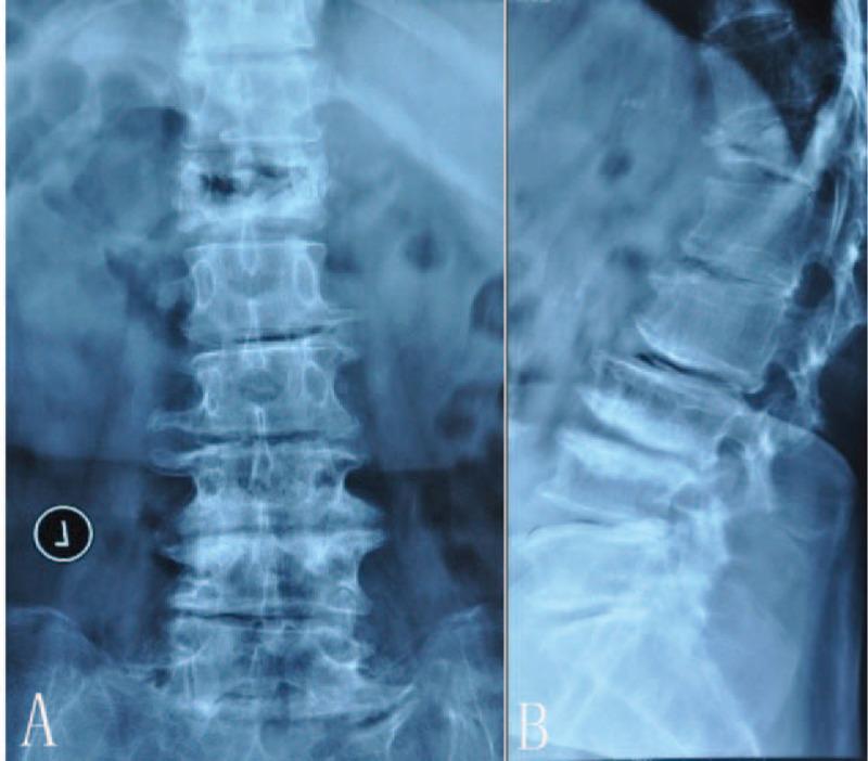 https://cdn.ncbi.nlm.nih.gov/pmc/blobs/c435/5709019/ff49a70a293d/medi-96-e8895-g002.jpg