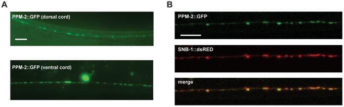 https://cdn.ncbi.nlm.nih.gov/pmc/blobs/c437/4014440/8d1aa241bcb9/pgen.1004297.g008.jpg