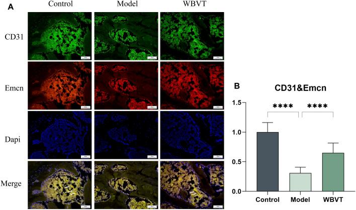 https://cdn.ncbi.nlm.nih.gov/pmc/blobs/c438/10590907/7e0b28df0b3c/fcell-11-1251634-g005.jpg