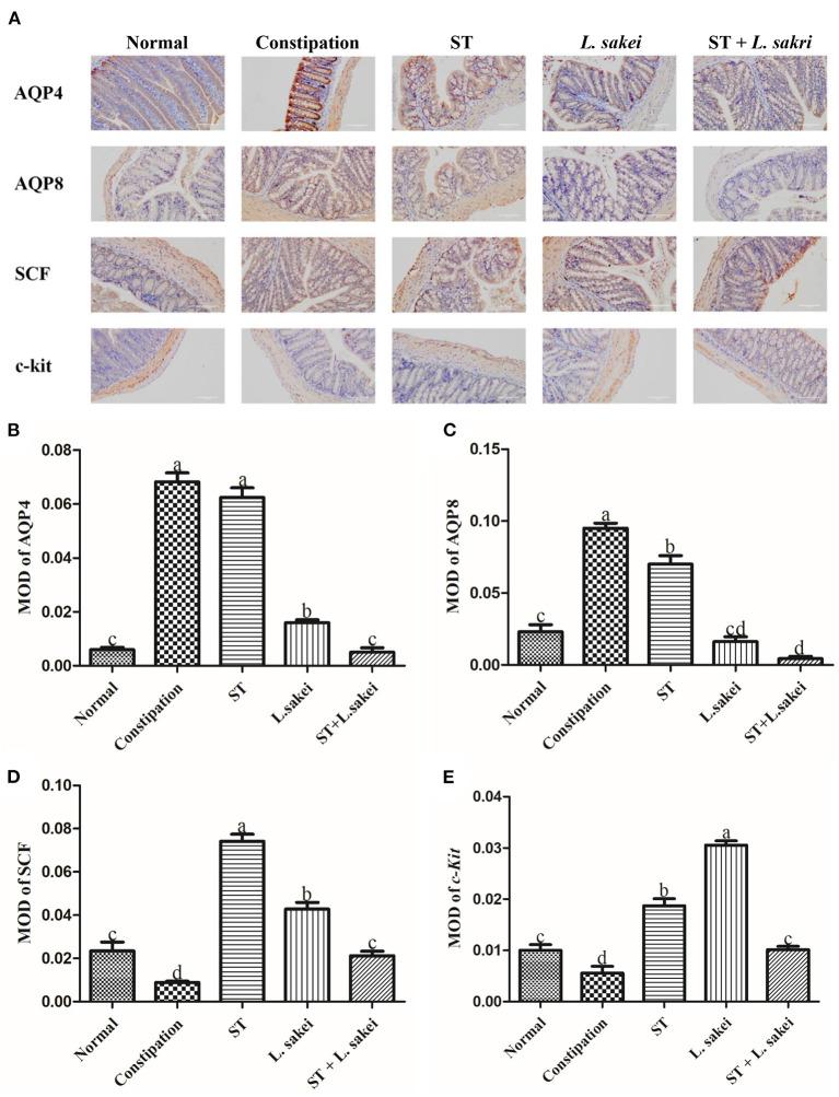https://cdn.ncbi.nlm.nih.gov/pmc/blobs/c43f/9849682/26bc16798f56/fnut-09-1039403-g0003.jpg