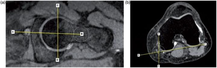 https://cdn.ncbi.nlm.nih.gov/pmc/blobs/c447/4765289/ccfe17b36736/hnu009f1p.jpg