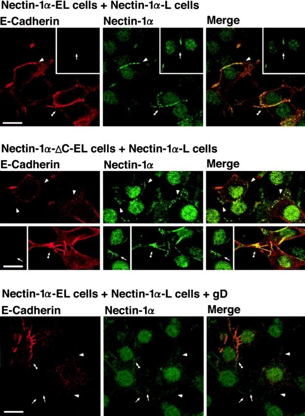https://cdn.ncbi.nlm.nih.gov/pmc/blobs/c452/2175253/33b187c2de06/JCB0003147.f10.jpg