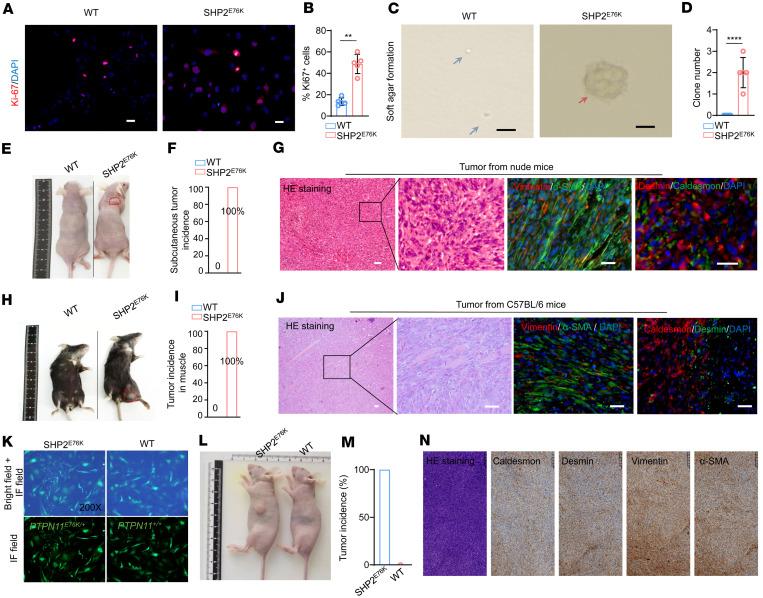 https://cdn.ncbi.nlm.nih.gov/pmc/blobs/c455/11141883/760d15a5fc82/jciinsight-9-170340-g001.jpg