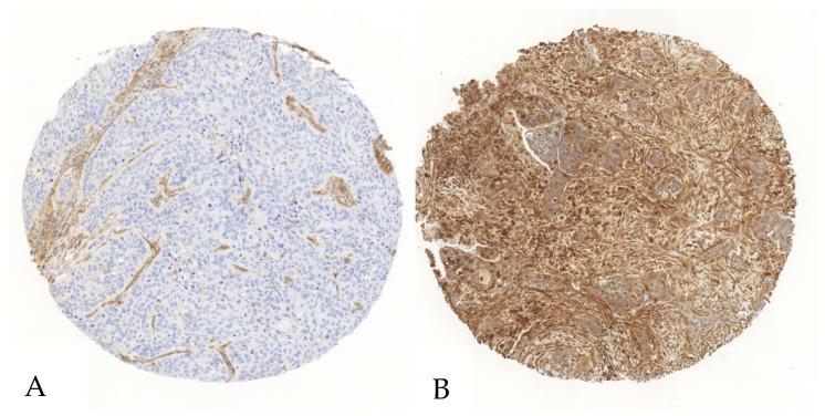 https://cdn.ncbi.nlm.nih.gov/pmc/blobs/c455/11987875/7fcad5952933/cancers-17-01142-g001.jpg