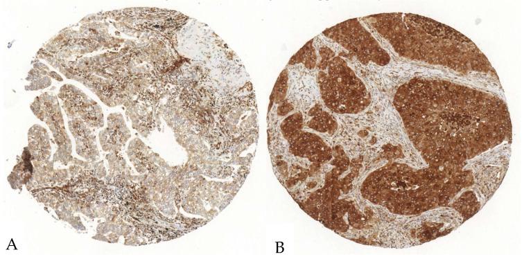 https://cdn.ncbi.nlm.nih.gov/pmc/blobs/c455/11987875/8912676f01bf/cancers-17-01142-g003.jpg
