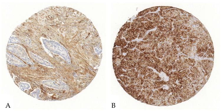 https://cdn.ncbi.nlm.nih.gov/pmc/blobs/c455/11987875/f45e66a1df1d/cancers-17-01142-g002.jpg