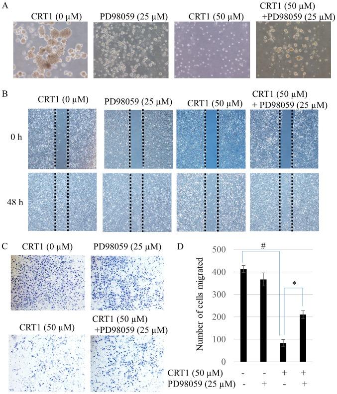 https://cdn.ncbi.nlm.nih.gov/pmc/blobs/c458/6131655/8d13d8daab88/MMR-18-04-3898-g04.jpg