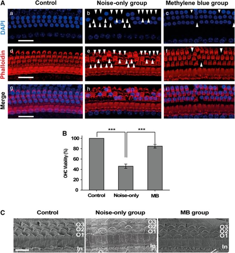 https://cdn.ncbi.nlm.nih.gov/pmc/blobs/c45a/4001318/37405e9daa5b/cddis2014170f2.jpg